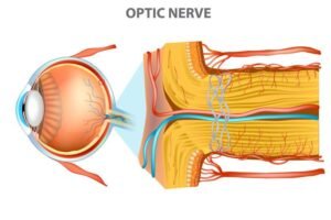 best eye clinic in gurugram