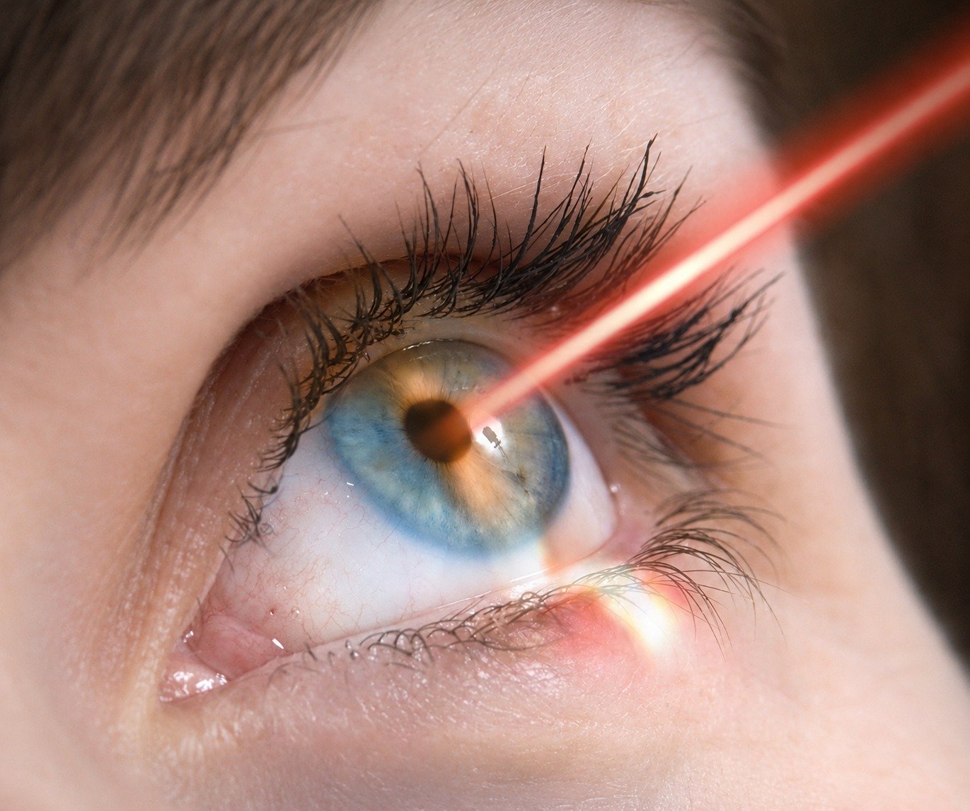 Best Eye Treatment in Gurgaon